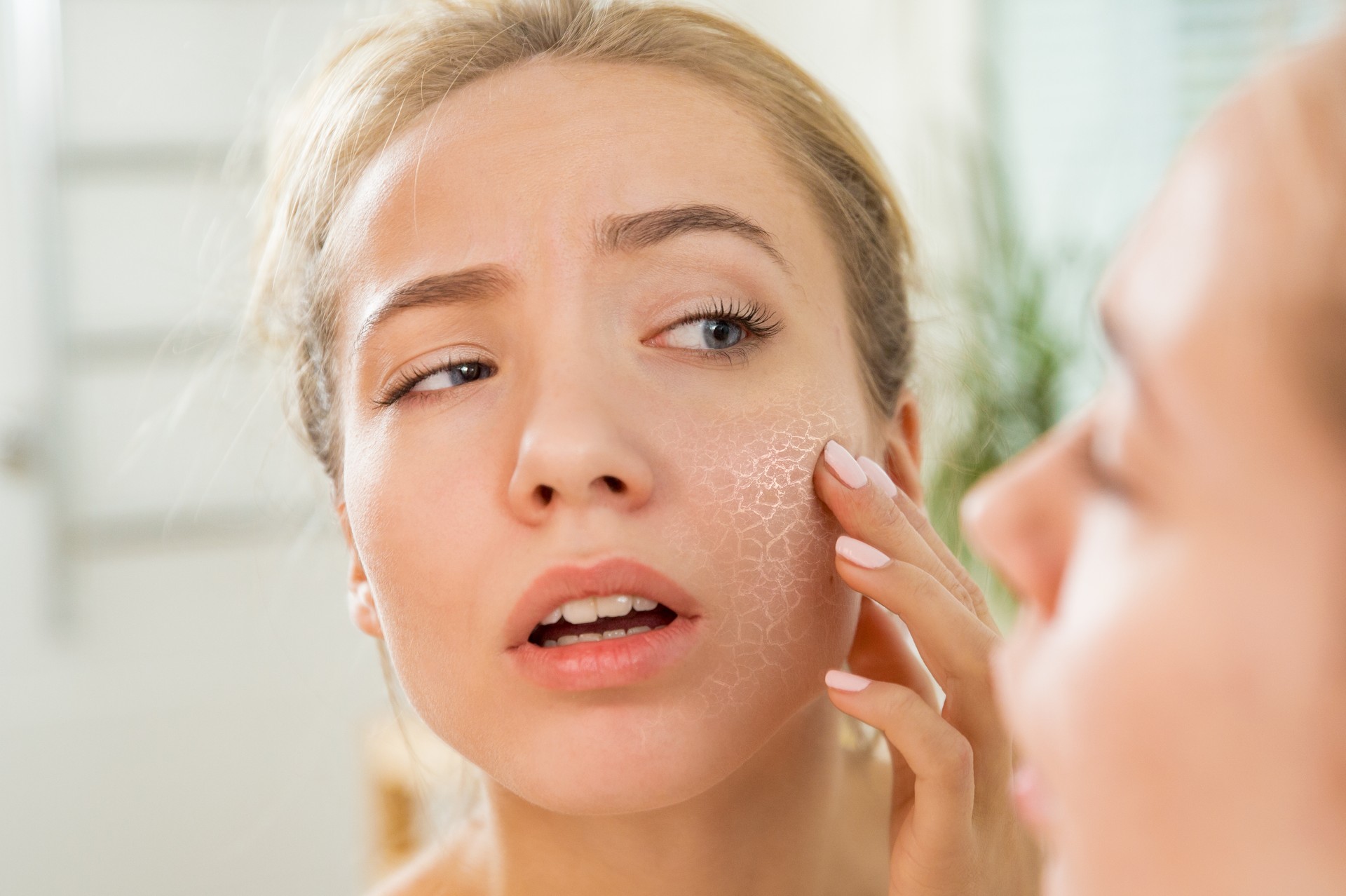 Young beautiful woman with dry irritated skin.